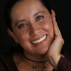 Example case of cosmetic dental treatment in Santa Rosa CA by James Klim, DDS