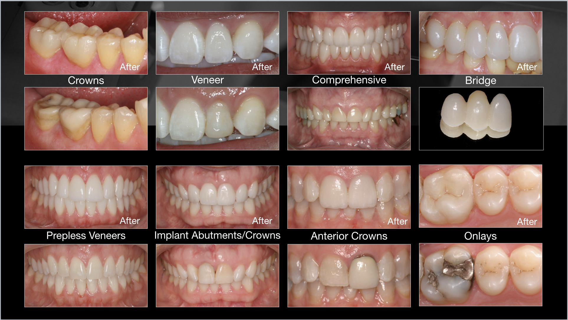 Screen Shot 2017-04-24 at 10.16.17 PM