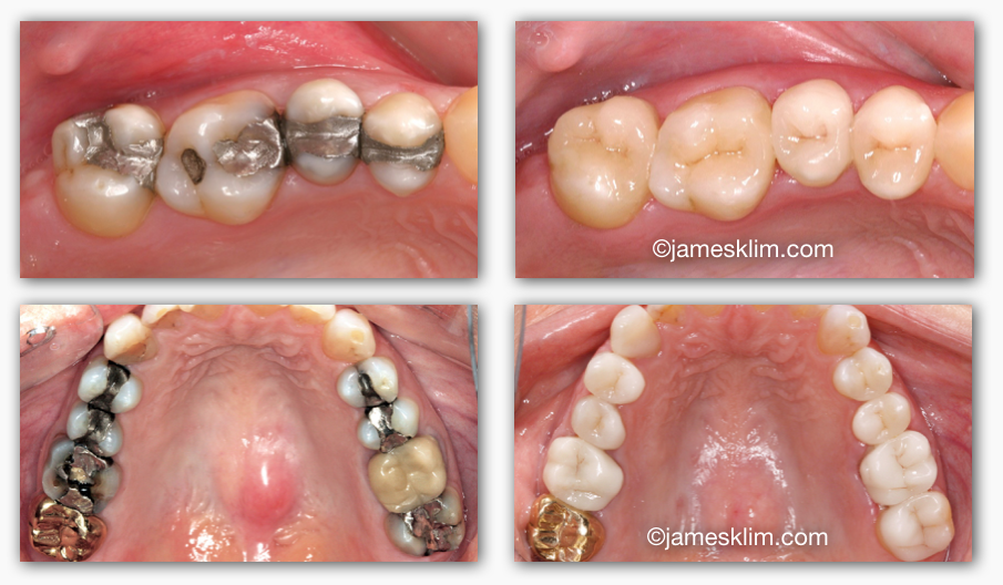 Screen Shot 2016-05-03 at 11.55.55 AM