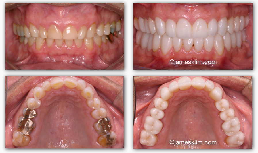 Screen Shot 2016-05-03 at 12.02.40 PM