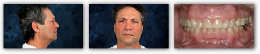 Screen Shot 2016-05-03 at 4.44.25 PM