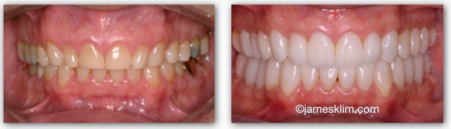 Screen Shot 2016-05-04 at 1.19.43 PM