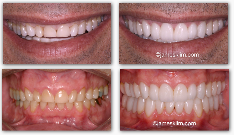 Screen Shot 2016-05-04 at 1.25.31 PM