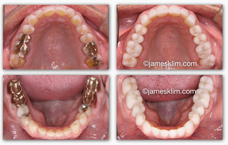 Screen Shot 2016-05-04 at 1.34.10 PM