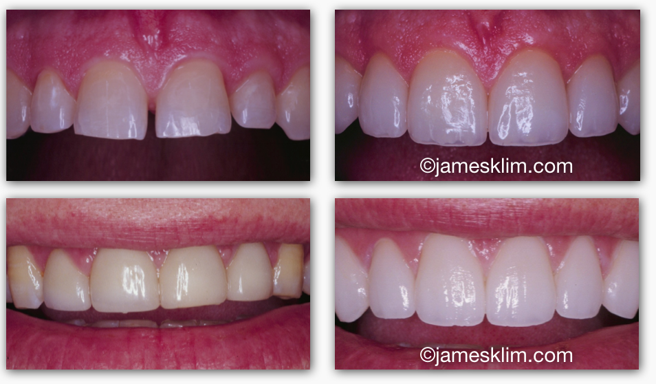 Screen Shot 2016-05-04 at 3.20.29 PM