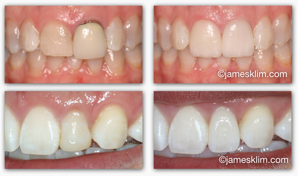 Screen Shot 2016-05-04 at 3.28.43 PM