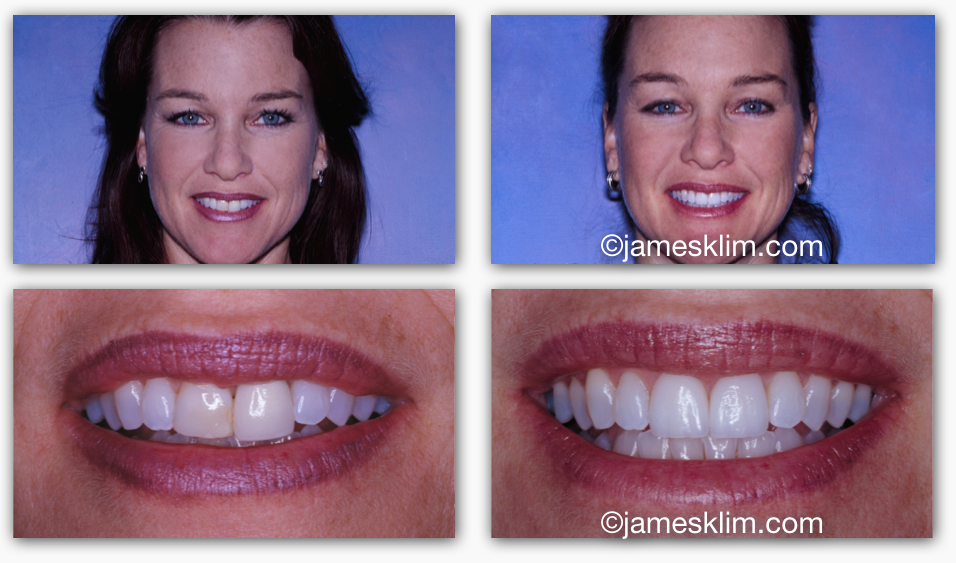 Screen Shot 2016-05-04 at 3.30.48 PM