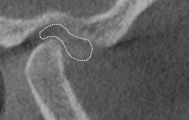 Screen Shot 2017-04-23 at 1.27.53 PM copy 2