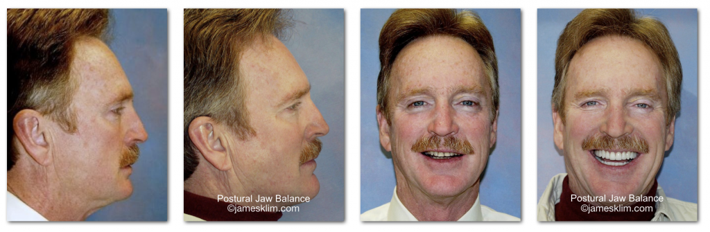 Screen Shot 2017-04-23 at 5.15.29 PM