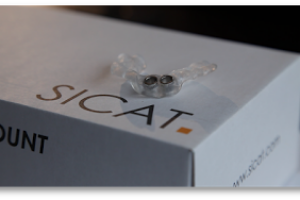 Guided Dental Implants- Replacing Missing teeth