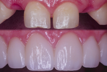 Bridges – James Klim, DDS