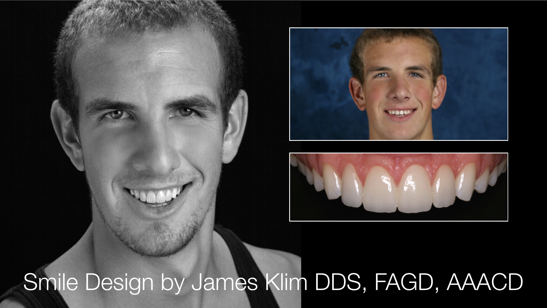 Screen Shot 2017-04-24 at 9.53.15 PM