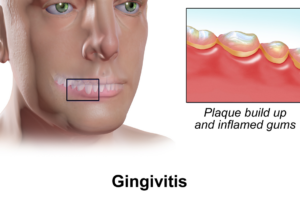 The Goal: No Disease