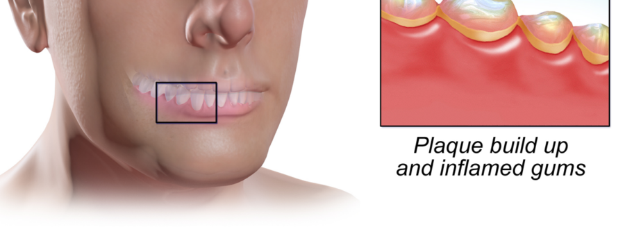 The Goal: No Disease