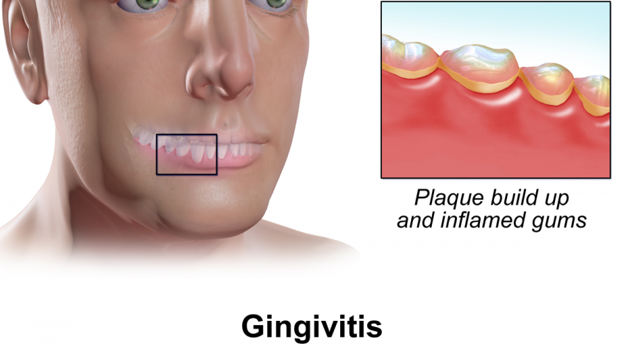 The Goal: No Disease