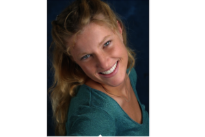 Example case of cosmetic dental treatment in Santa Rosa CA